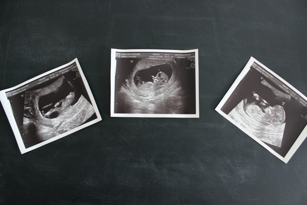 13 Weeks Baby T #3